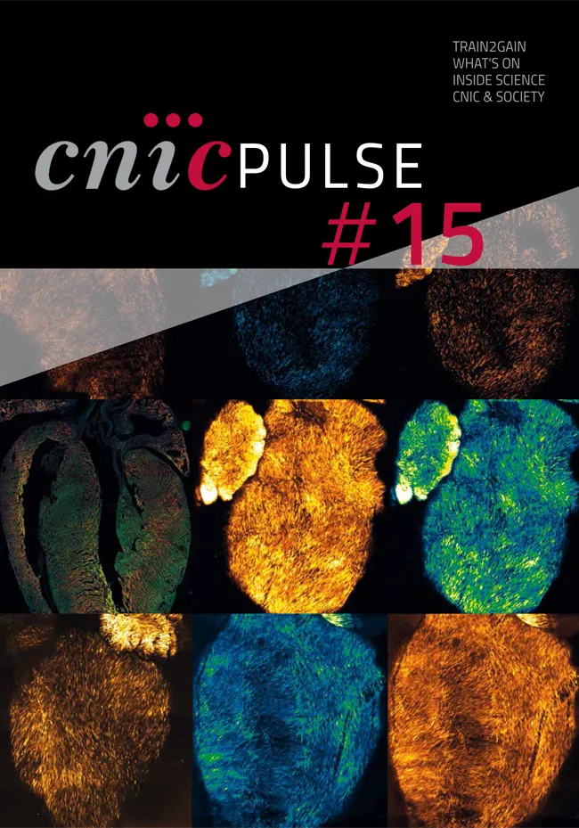 CNIC PULSE 15
